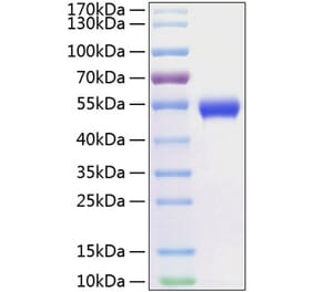 SDS-PAGE - Recombinant Human CD5 Protein (C-terminal His Tag) (A330364) - Antibodies.com