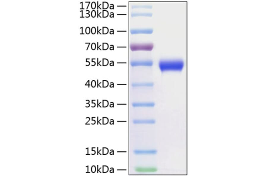 SDS-PAGE - Recombinant Human CD5 Protein (C-terminal His Tag) (A330364) - Antibodies.com