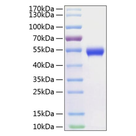SDS-PAGE - Recombinant Human CD5 Protein (C-terminal His Tag) (A330364) - Antibodies.com