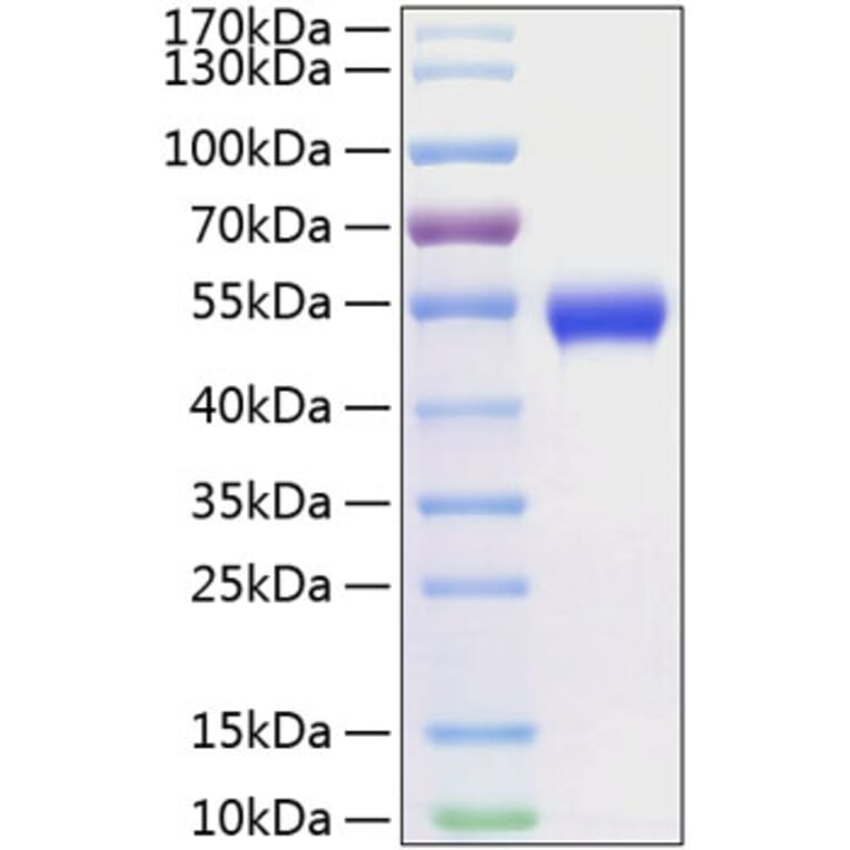 SDS-PAGE - Recombinant Human CD5 Protein (C-terminal His Tag) (A330364) - Antibodies.com