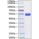 SDS-PAGE - Recombinant Human CD5 Protein (C-terminal His Tag) (A330364) - Antibodies.com