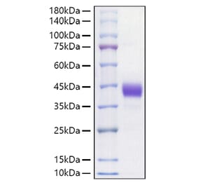 SDS-PAGE - Recombinant Mouse CD52 Protein (C-terminal Human Fc Tag) (A330365) - Antibodies.com
