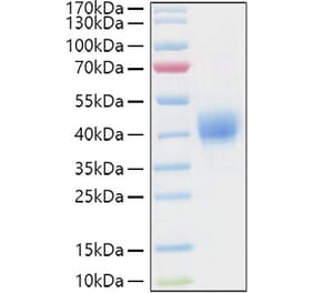 SDS-PAGE - Recombinant Human CD52 Protein (C-terminal Human Fc and Avi Tag) (A330366) - Antibodies.com