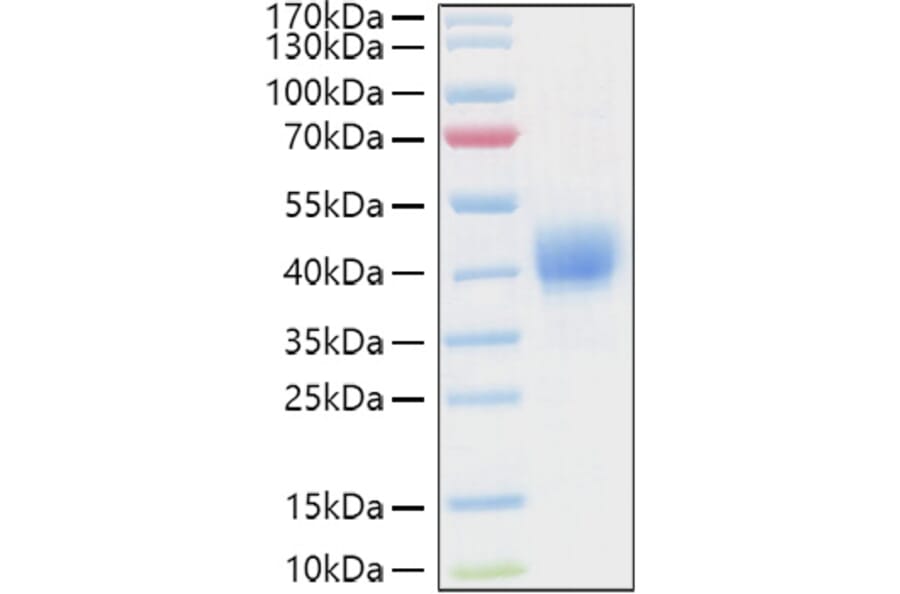 SDS-PAGE - Recombinant Human CD52 Protein (C-terminal Human Fc and Avi Tag) (A330366) - Antibodies.com