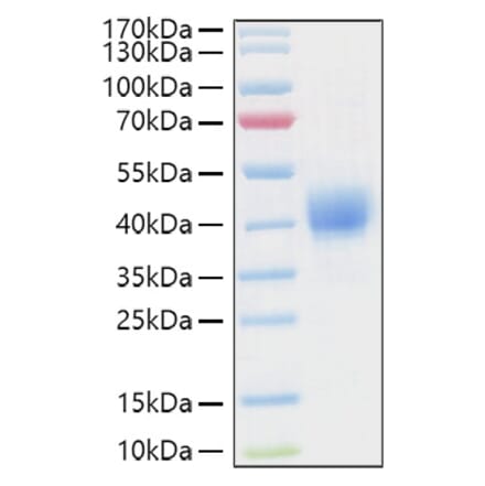 SDS-PAGE - Recombinant Human CD52 Protein (C-terminal Human Fc and Avi Tag) (A330366) - Antibodies.com
