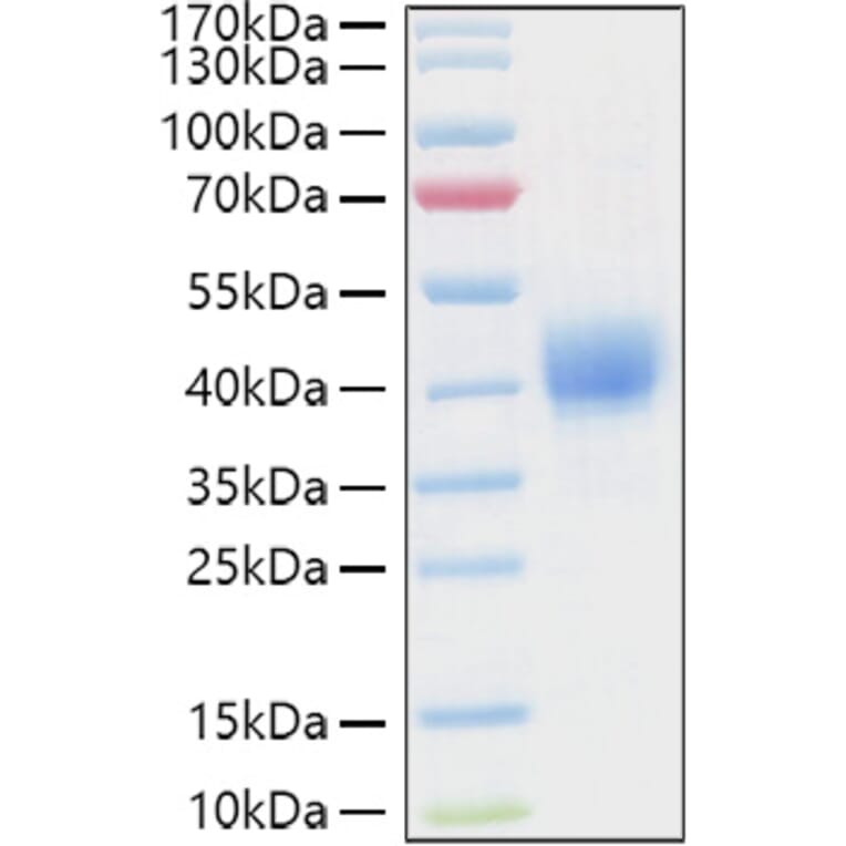 SDS-PAGE - Recombinant Human CD52 Protein (C-terminal Human Fc and Avi Tag) (A330366) - Antibodies.com