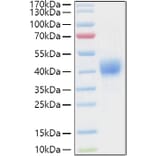 SDS-PAGE - Recombinant Human CD52 Protein (C-terminal Human Fc and Avi Tag) (A330366) - Antibodies.com