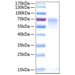 SDS-PAGE - Recombinant Human CD55 Protein (C-terminal His Tag) (A330367) - Antibodies.com