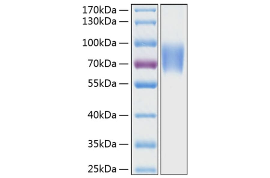 SDS-PAGE - Recombinant Human CD58 Protein (C-terminal Human Fc and His Tag) (A330368) - Antibodies.com