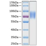 SDS-PAGE - Recombinant Human CD58 Protein (C-terminal Human Fc and His Tag) (A330368) - Antibodies.com