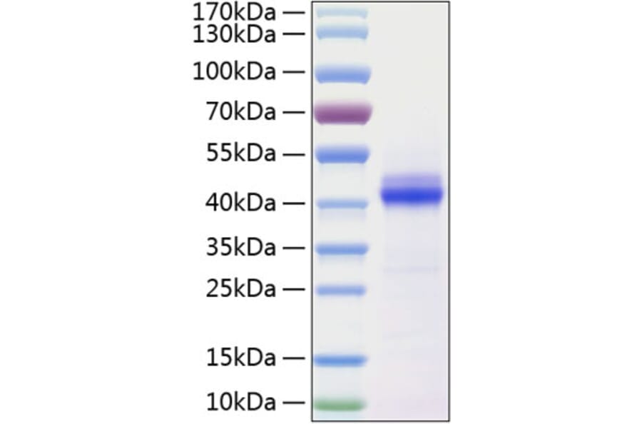 SDS-PAGE - Recombinant Human CD5L Protein (C-terminal His Tag) (A330369) - Antibodies.com