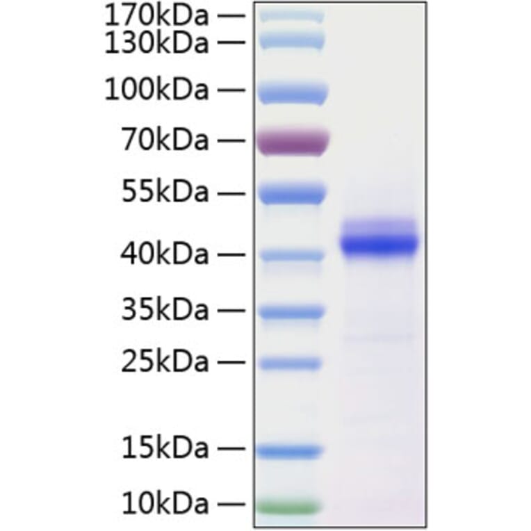 SDS-PAGE - Recombinant Human CD5L Protein (C-terminal His Tag) (A330369) - Antibodies.com