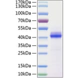 SDS-PAGE - Recombinant Human CD5L Protein (C-terminal His Tag) (A330369) - Antibodies.com