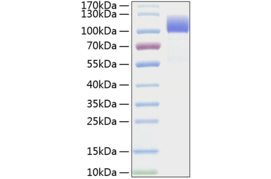 SDS-PAGE - Recombinant Human CD6 Protein (C-terminal Human Fc and His Tag) (A330370) - Antibodies.com