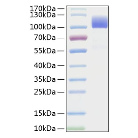 SDS-PAGE - Recombinant Human CD6 Protein (C-terminal Human Fc and His Tag) (A330370) - Antibodies.com