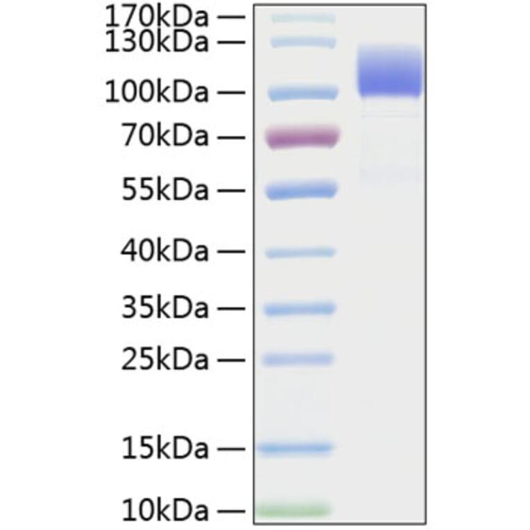 SDS-PAGE - Recombinant Human CD6 Protein (C-terminal Human Fc and His Tag) (A330370) - Antibodies.com
