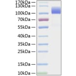 SDS-PAGE - Recombinant Human CD6 Protein (C-terminal Human Fc and His Tag) (A330370) - Antibodies.com
