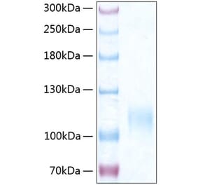 SDS-PAGE - Recombinant Human CD62E Protein (C-terminal His Tag) (A330371) - Antibodies.com