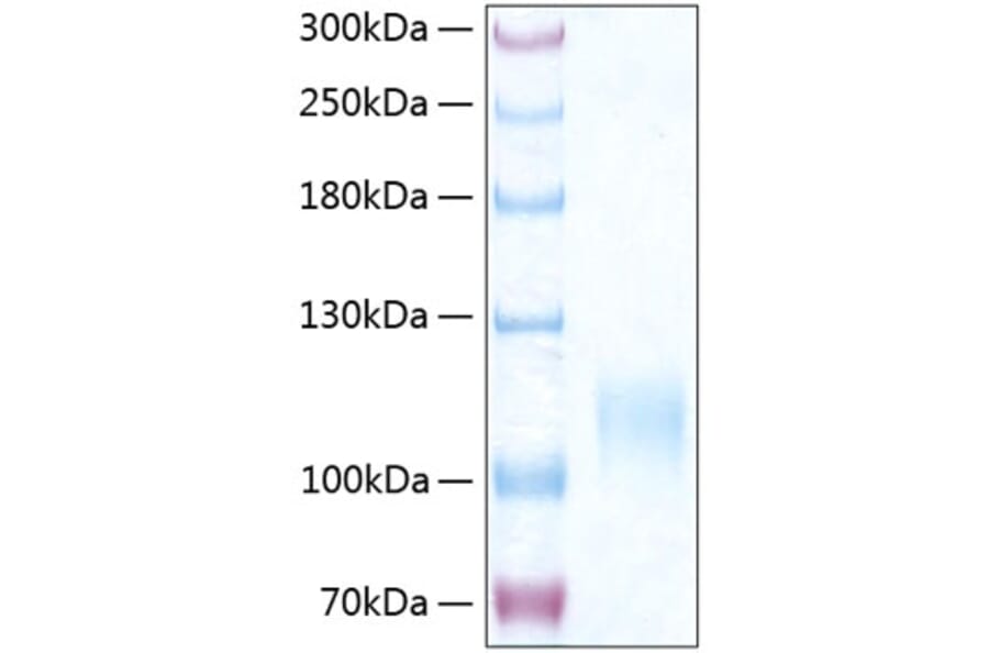 SDS-PAGE - Recombinant Human CD62E Protein (C-terminal His Tag) (A330371) - Antibodies.com