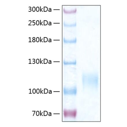 SDS-PAGE - Recombinant Human CD62E Protein (C-terminal His Tag) (A330371) - Antibodies.com
