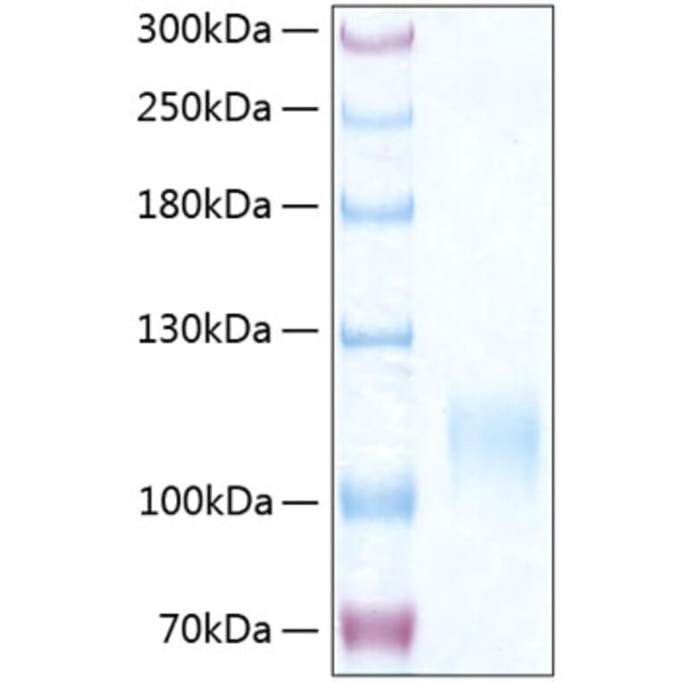 SDS-PAGE - Recombinant Human CD62E Protein (C-terminal His Tag) (A330371) - Antibodies.com