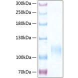 SDS-PAGE - Recombinant Human CD62E Protein (C-terminal His Tag) (A330371) - Antibodies.com