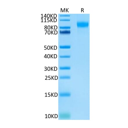 Tris-Bis PAGE - Recombinant Human CD62E Protein (Biotin) (C-terminal His and Avi Tag) (A330372) - Antibodies.com