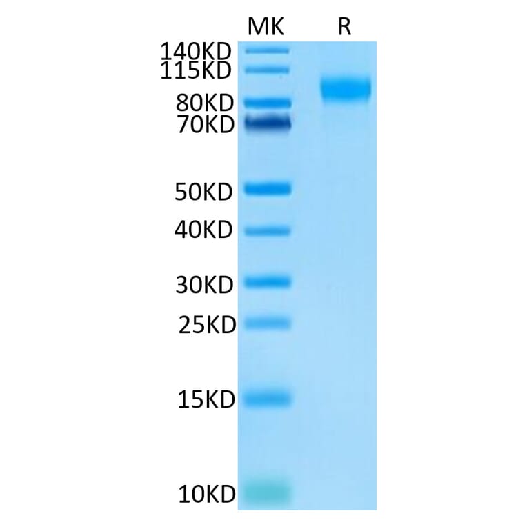 Tris-Bis PAGE - Recombinant Human CD62E Protein (Biotin) (C-terminal His and Avi Tag) (A330372) - Antibodies.com