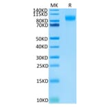 Tris-Bis PAGE - Recombinant Human CD62E Protein (Biotin) (C-terminal His and Avi Tag) (A330372) - Antibodies.com