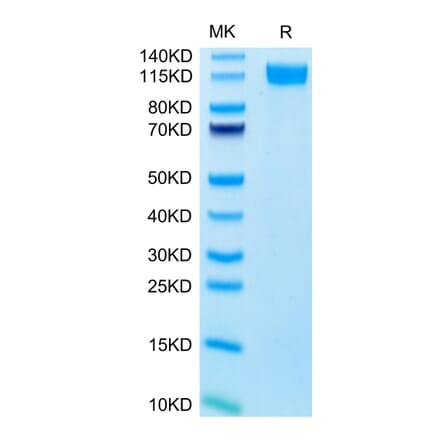 Tris-Bis PAGE - Recombinant Human CD62E Protein (C-terminal Human Fc Tag) (A330373) - Antibodies.com