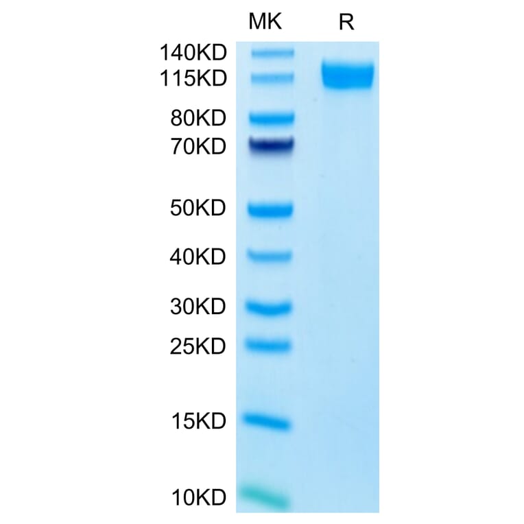 Tris-Bis PAGE - Recombinant Human CD62E Protein (C-terminal Human Fc Tag) (A330373) - Antibodies.com