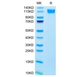 Tris-Bis PAGE - Recombinant Human CD62E Protein (C-terminal Human Fc Tag) (A330373) - Antibodies.com