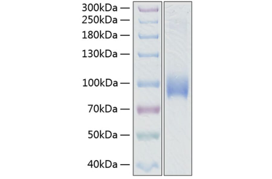 SDS-PAGE - Recombinant Human CD62L Protein (C-terminal Human Fc and His Tag) (A330374) - Antibodies.com