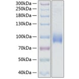 SDS-PAGE - Recombinant Human CD62L Protein (C-terminal Human Fc and His Tag) (A330374) - Antibodies.com