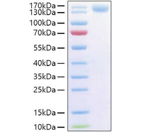 SDS-PAGE - Recombinant Human CD62P Protein (C-terminal Human Fc and His Tag) (A330375) - Antibodies.com