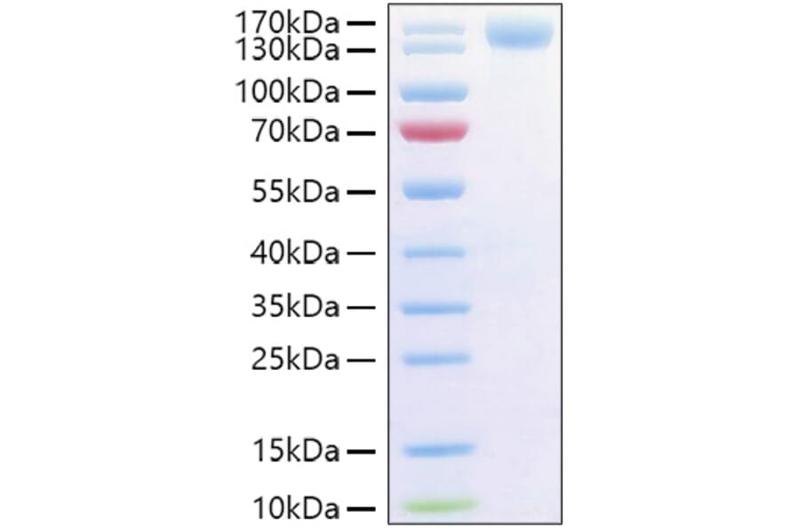 SDS-PAGE - Recombinant Human CD62P Protein (C-terminal Human Fc and His Tag) (A330375) - Antibodies.com
