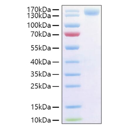SDS-PAGE - Recombinant Human CD62P Protein (C-terminal Human Fc and His Tag) (A330375) - Antibodies.com