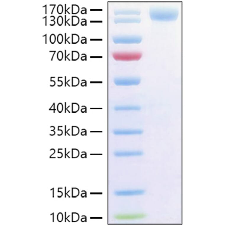 SDS-PAGE - Recombinant Human CD62P Protein (C-terminal Human Fc and His Tag) (A330375) - Antibodies.com
