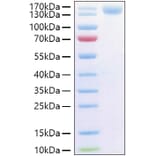 SDS-PAGE - Recombinant Human CD62P Protein (C-terminal Human Fc and His Tag) (A330375) - Antibodies.com