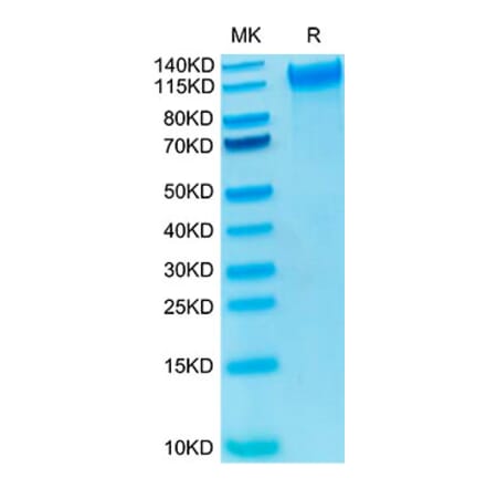 Tris-Bis PAGE - Recombinant Human CD62P Protein (Biotin) (C-terminal His and Avi Tag) (A330376) - Antibodies.com