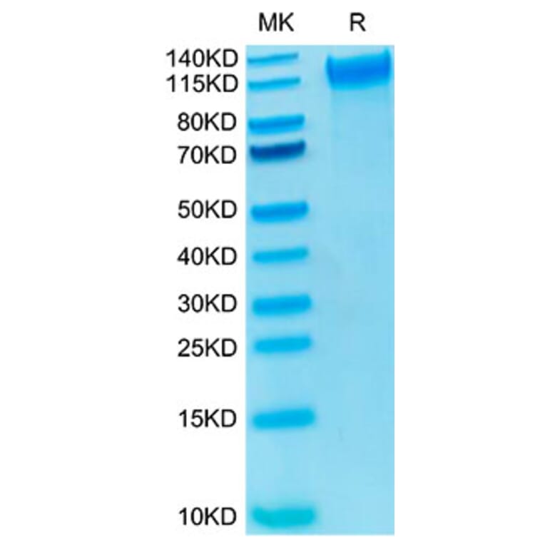 Tris-Bis PAGE - Recombinant Human CD62P Protein (Biotin) (C-terminal His and Avi Tag) (A330376) - Antibodies.com