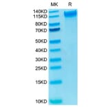 Tris-Bis PAGE - Recombinant Human CD62P Protein (Biotin) (C-terminal His and Avi Tag) (A330376) - Antibodies.com