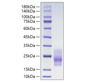 SDS-PAGE - Recombinant Human CD63 Protein (C-terminal His Tag) (A330377) - Antibodies.com