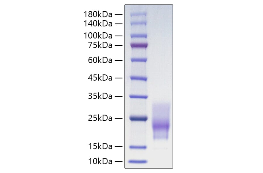 SDS-PAGE - Recombinant Human CD63 Protein (C-terminal His Tag) (A330377) - Antibodies.com