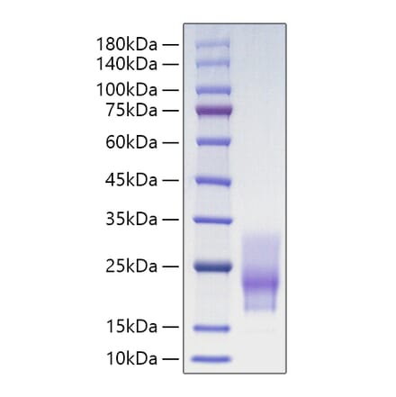 SDS-PAGE - Recombinant Human CD63 Protein (C-terminal His Tag) (A330377) - Antibodies.com