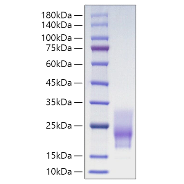SDS-PAGE - Recombinant Human CD63 Protein (C-terminal His Tag) (A330377) - Antibodies.com