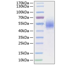 SDS-PAGE - Recombinant Human CD64 Protein (C-terminal His Tag) (A330378) - Antibodies.com