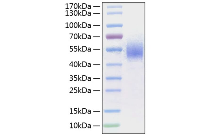 SDS-PAGE - Recombinant Human CD64 Protein (C-terminal His Tag) (A330378) - Antibodies.com