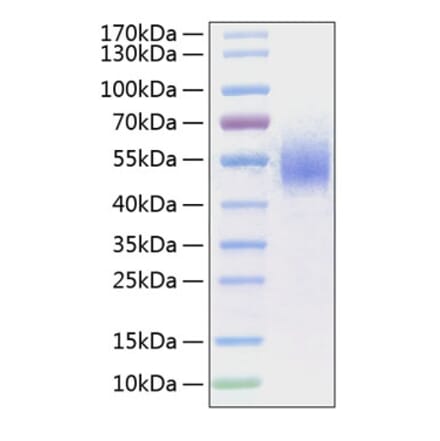 SDS-PAGE - Recombinant Human CD64 Protein (C-terminal His Tag) (A330378) - Antibodies.com