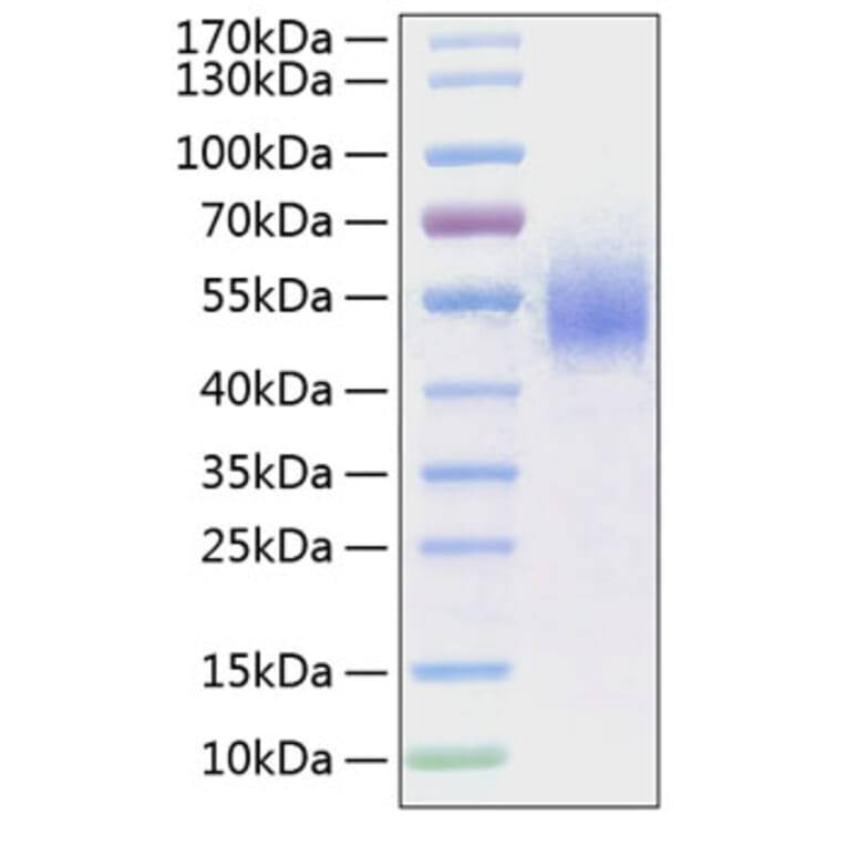 SDS-PAGE - Recombinant Human CD64 Protein (C-terminal His Tag) (A330378) - Antibodies.com